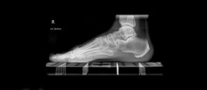 Röntgen Fuss | Praxis für Radiologische Diagnostik Hanau